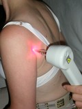 laser rikta spalla